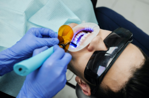 teeth cleaning